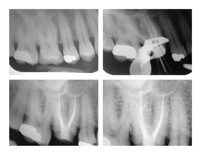 Endo rads resize.jpg